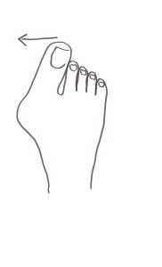 srovnavač vbočeného palce - princip